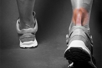 An Achilles Tendon Injury Can Cause Severe Pain