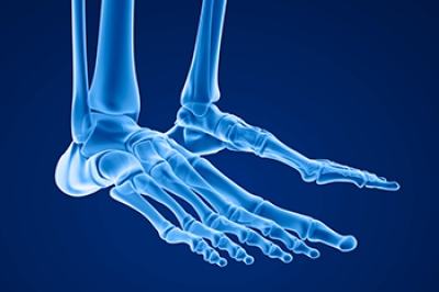 Symptoms of Foot Stress Fractures